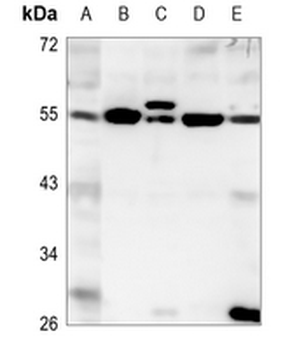 Anti-EYA1 Antibody