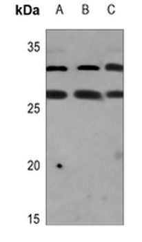Anti-CAPNS2 Antibody