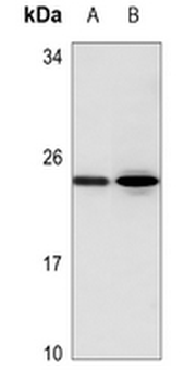 Anti-AID Antibody