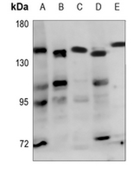 Anti-ADAMTS18 Antibody