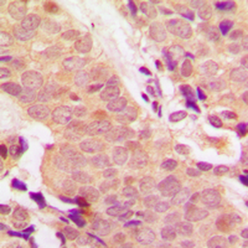Anti-STAT5 (pY694/699) Antibody