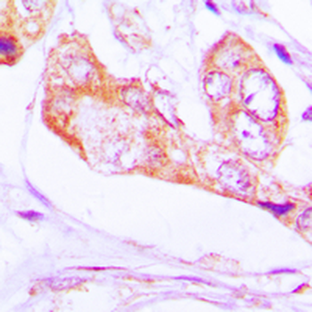 Anti-PNPT1 Antibody
