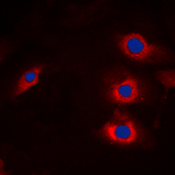 Anti-HECW2 Antibody