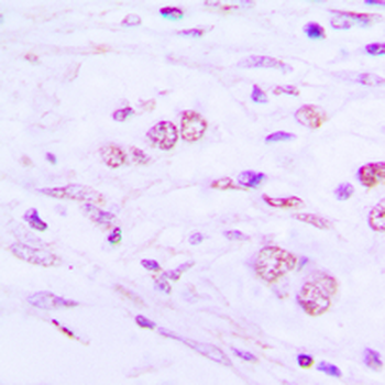 Anti-BAIAP2L1 Antibody