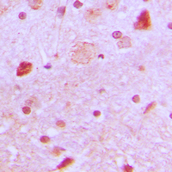 Anti-TBX22 Antibody