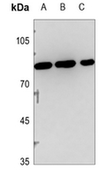 Anti-PNPLA8 Antibody