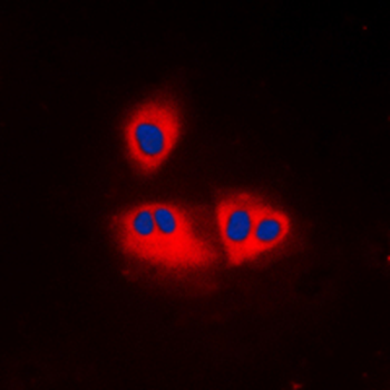 Anti-ACOT2 Antibody