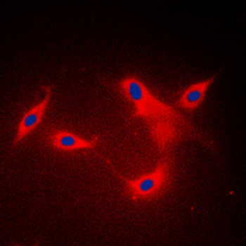 Anti-LYPLA1 Antibody