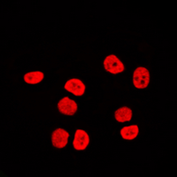 Anti-BAF170 Antibody