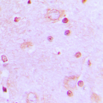 Anti-SRSF7 Antibody