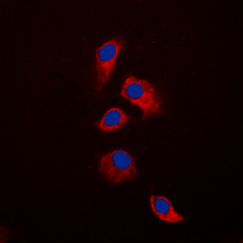 Anti-Osteoprotegerin Antibody
