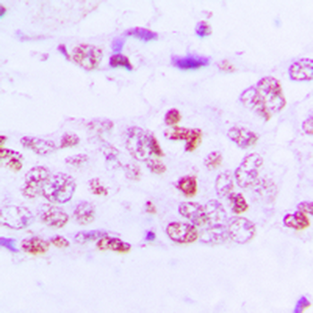 Anti-GSK3 alpha/beta (pY279/216) Antibody