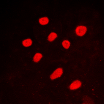 Anti-CTBP2 Antibody