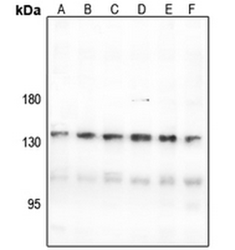 Anti-CNGB1 Antibody