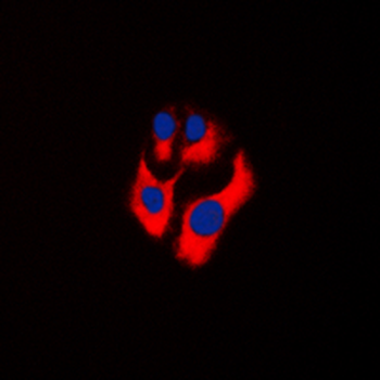 Anti-CKMT2 Antibody