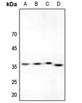 Anti-ACER1 Antibody