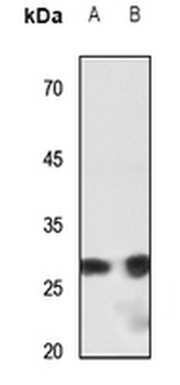 Anti-SHOX Antibody