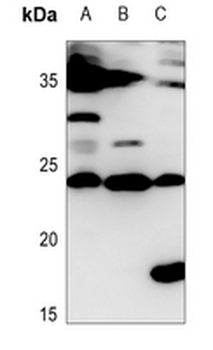 Anti-IL-28A Antibody