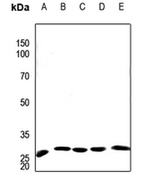 Anti-APOA1BP Antibody