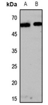 Anti-Melanopsin Antibody