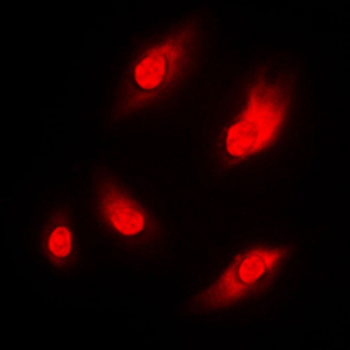 Anti-NAA15 Antibody