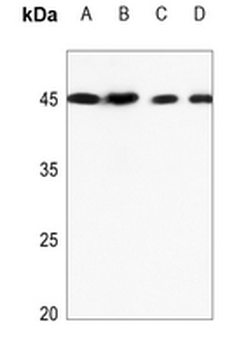 Anti-TRIB3 Antibody