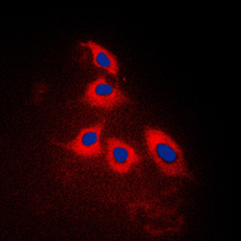 Anti-ARRDC3 Antibody