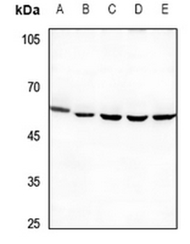 Anti-PPP4R1L Antibody