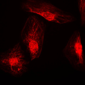 Anti-RANBP6 Antibody