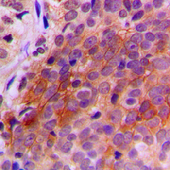 Anti-TXNRD2 Antibody