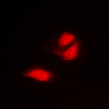 Anti-G3BP1 Antibody