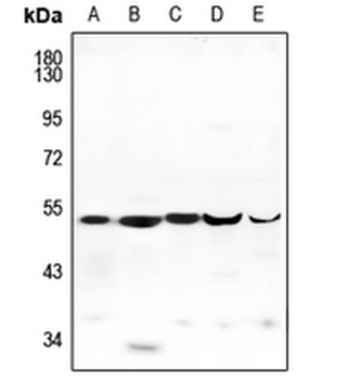 Anti-ENDOGL1 Antibody