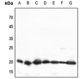 Anti-TOM20 Antibody