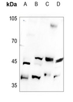 Anti-B4GALT5 Antibody