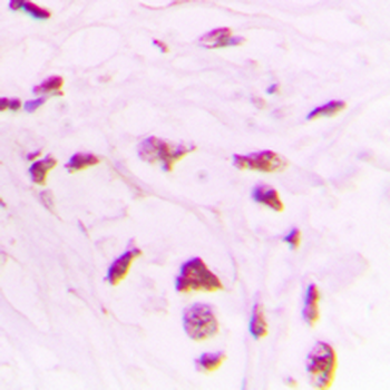 Anti-STK17B Antibody