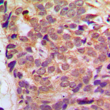 Anti-RGS10 Antibody