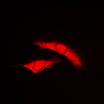 Anti-RAD23B Antibody