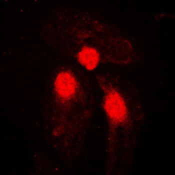 Anti-SMAD3 (pS204) Antibody