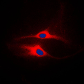 Anti-LCK Antibody