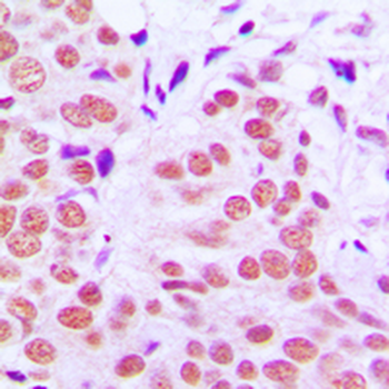 Anti-c-Jun (pT91) Antibody