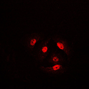 Anti-Cofilin (pS3) Antibody