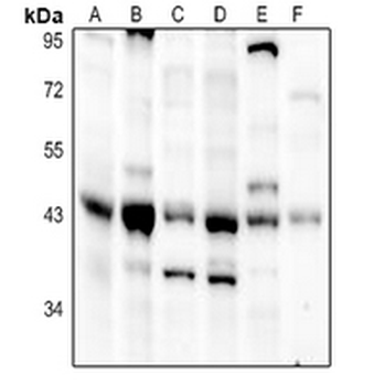 Anti-DHPS Antibody