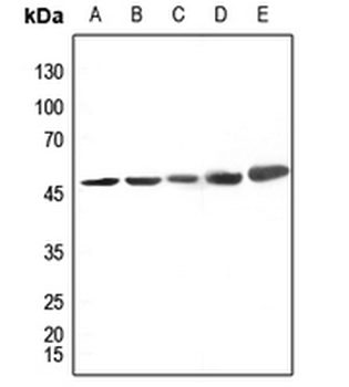 Anti-CK1 delta Antibody