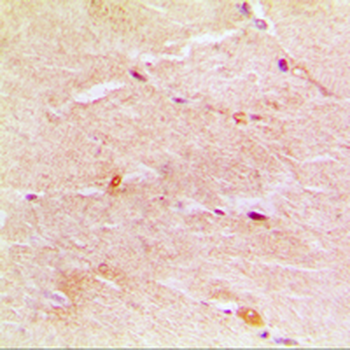 Anti-Gamma-actin-1 Antibody