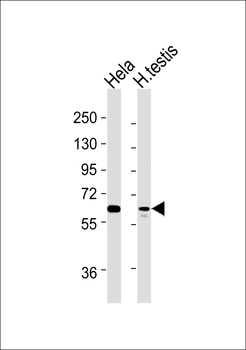 Artemis (pS516) Antibody