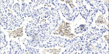 Recombinant PD-L1 antibody [AK94]