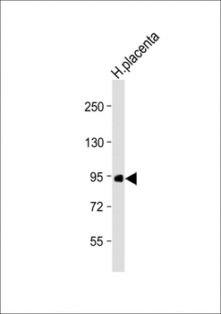 F13A1 Antibody (N-Term)