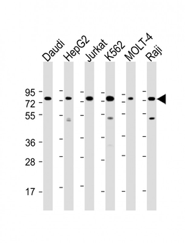 PABPC3 Antibody (N-Term)