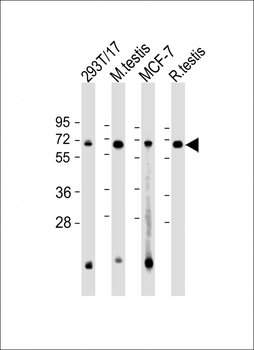 FEM1B Antibody (C-Term)