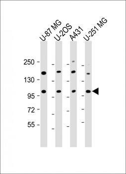 THSD1 Antibody (C-Term)